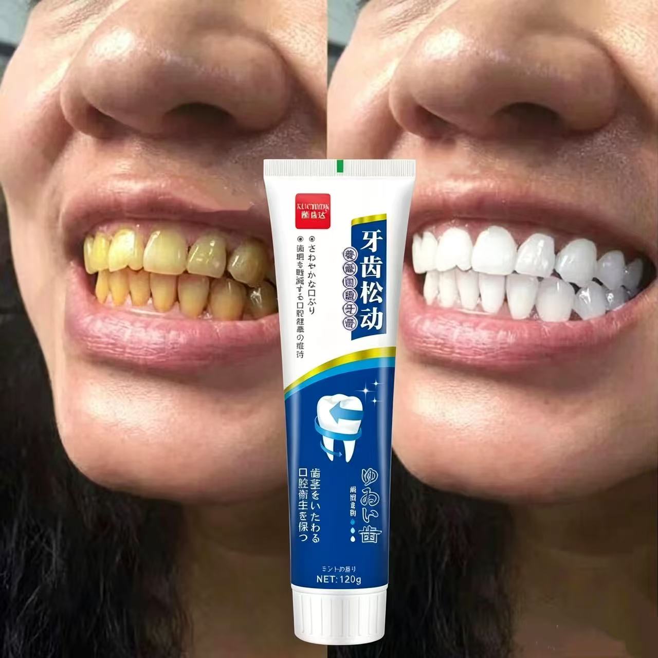Pasta de Dientes Importada de  - Teeth Whitening Japanese reseña y precio