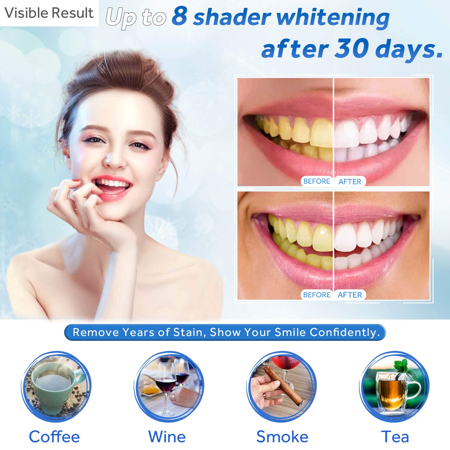 Jeringa de repuesto de Gel par - Teeth Whitening/Bleaching reseña y precio