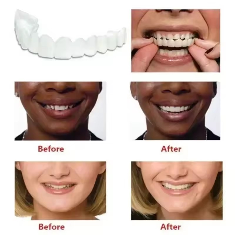 Carillas Dentales, Blanqueamie - Teeth Whitening Vape reseña y precio