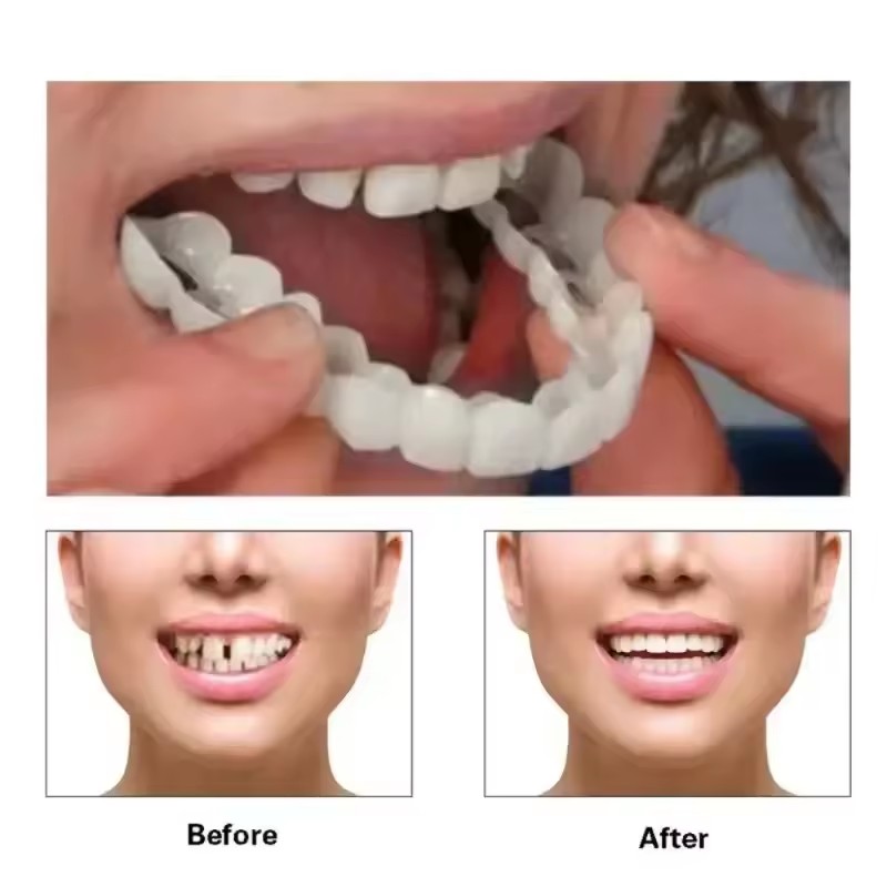 Carillas Dentales, Blanqueamie - Teeth Whitening Vape reseña y precio