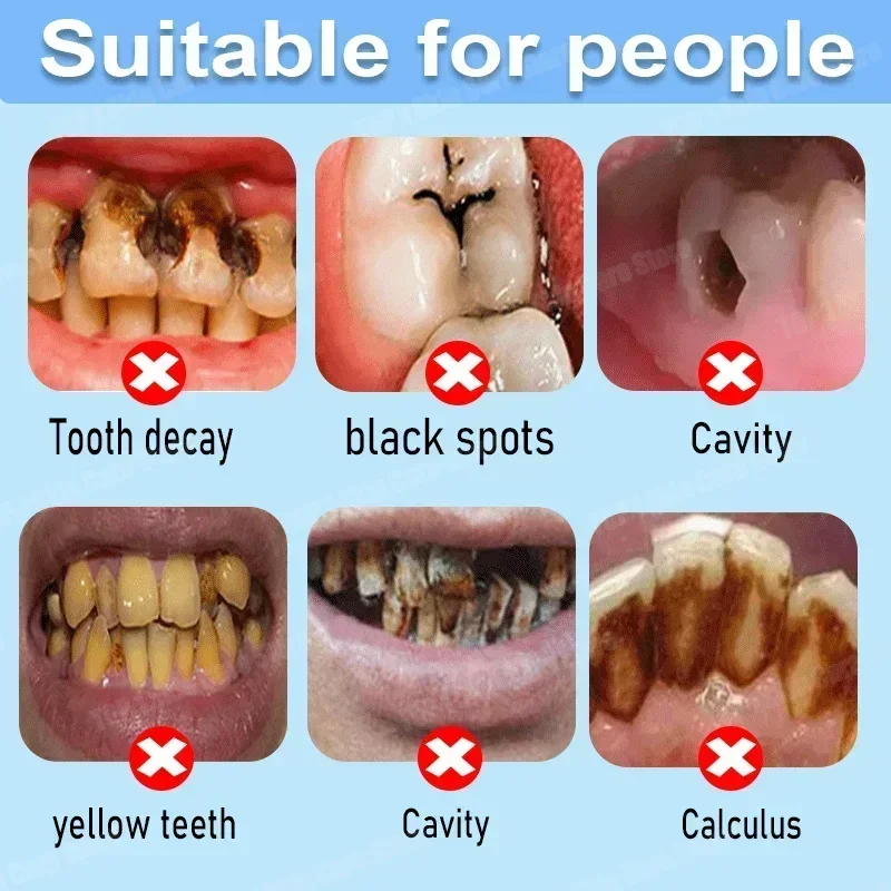 Pasta Dental Anticaries que Re - Teeth Whitening Uv reseña y precio