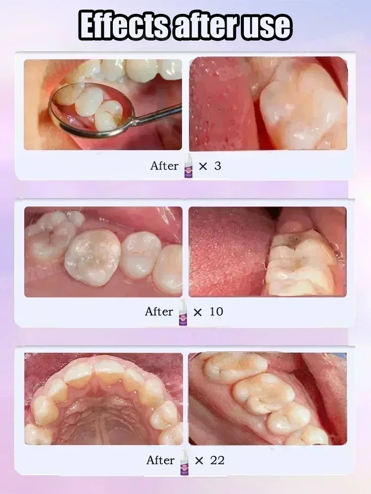 Pasta de dientes para limpieza - Teeth Whitening Uv reseña y precio