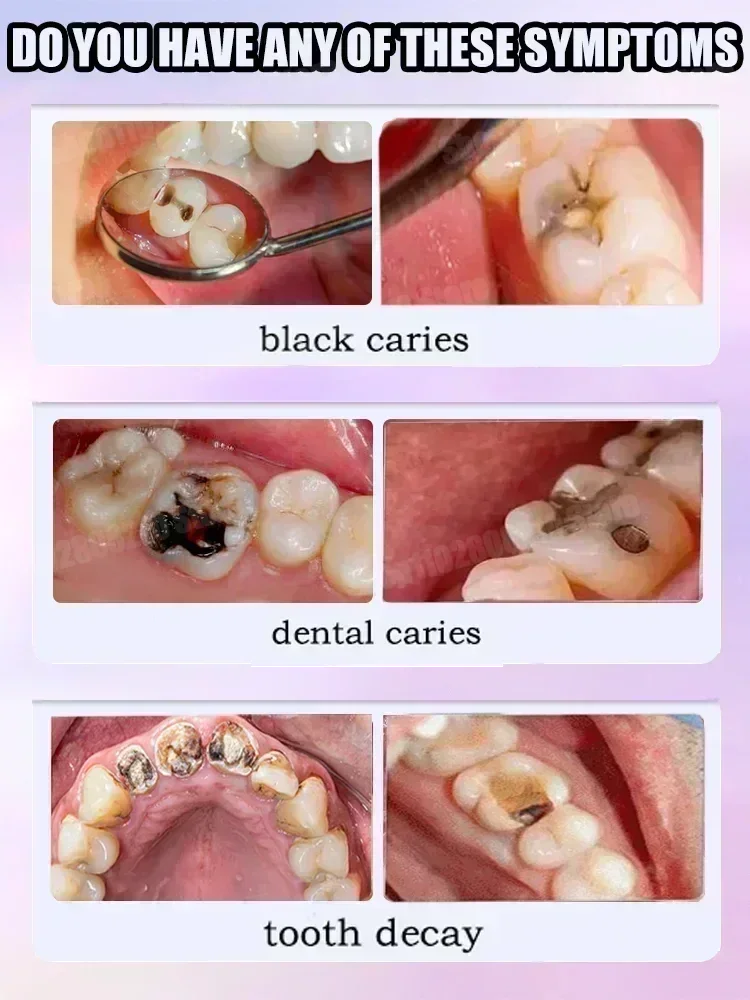 Pasta de dientes para limpieza - Teeth Whitening Uv reseña y precio